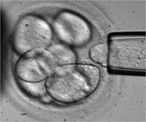 stemcells12