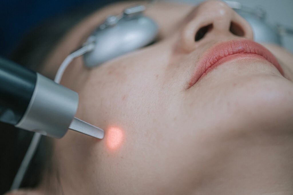 Woman getting a laser treatment at a med spa