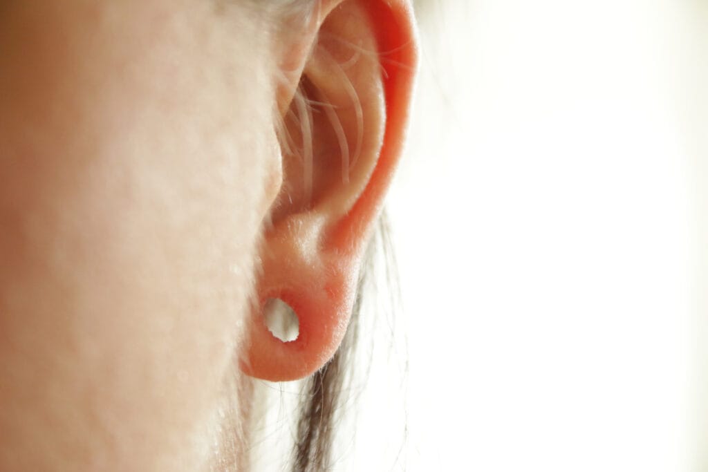 Stretched earlobes